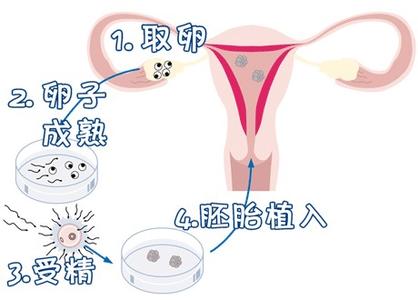 王主任